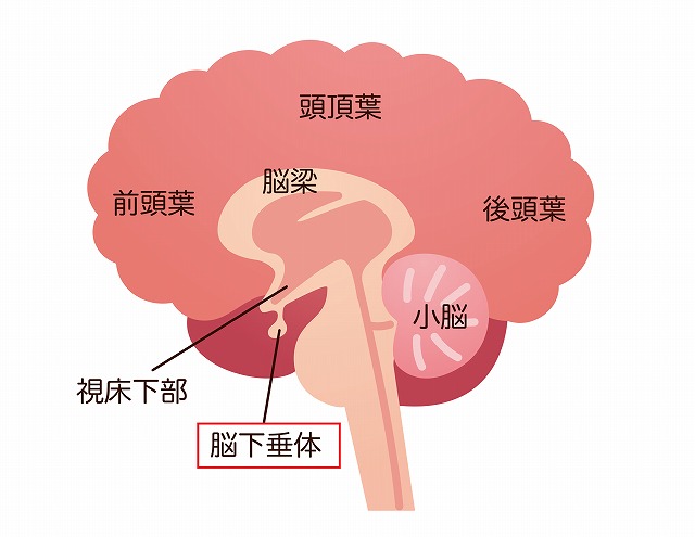 下垂体病変とは